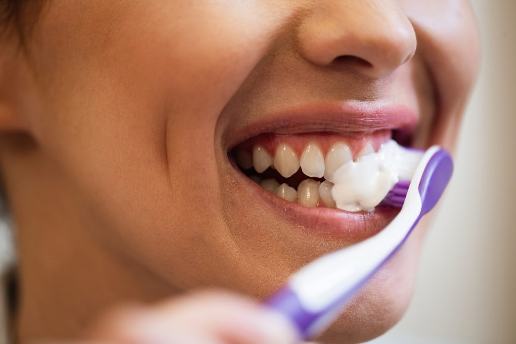 Veneers Sunshine Coast 1